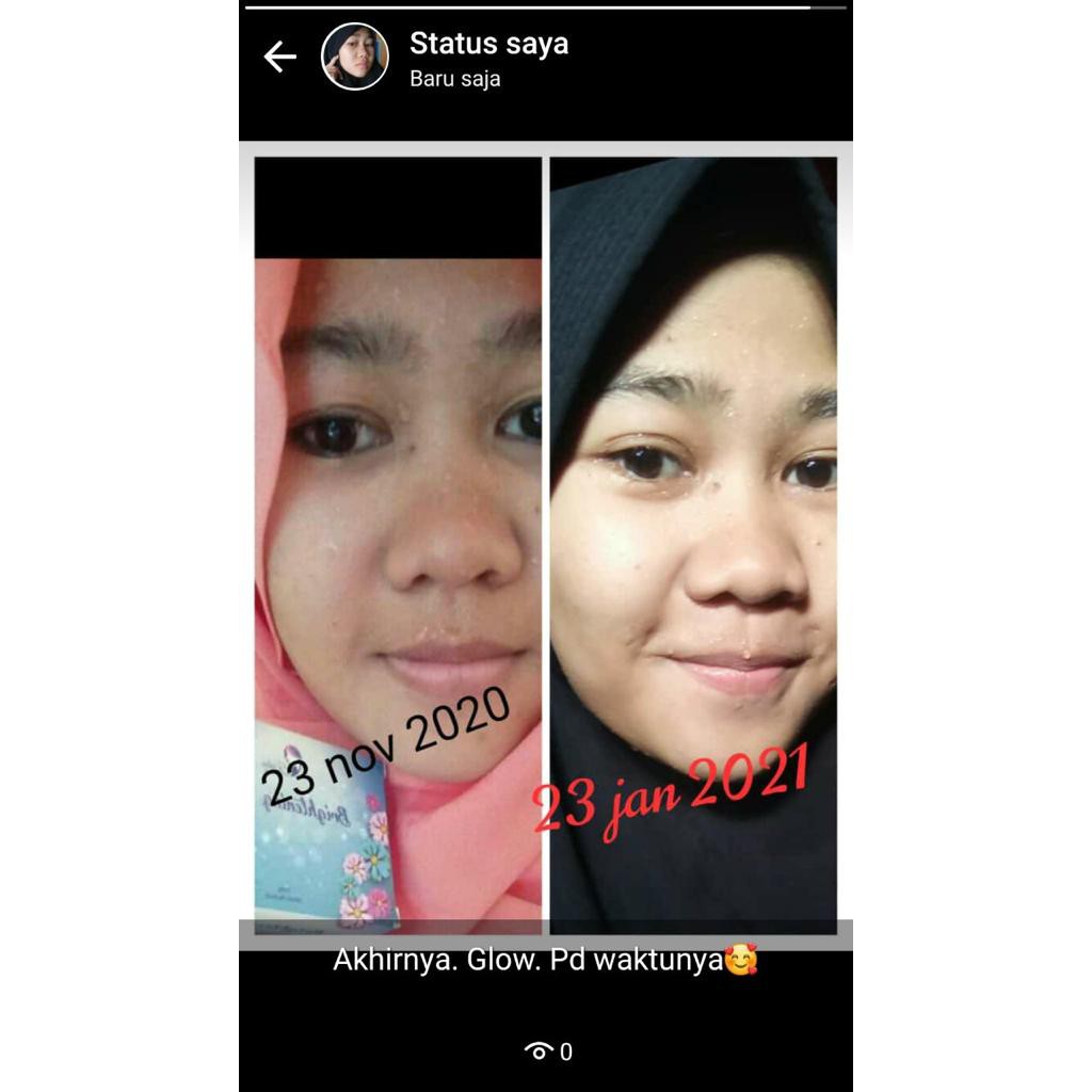 Sabun Kedas Beauty Original