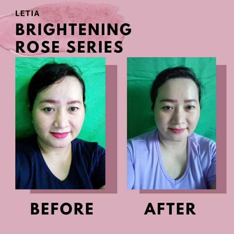 letia brightening rose series / paket advance / paket lengkap skincare