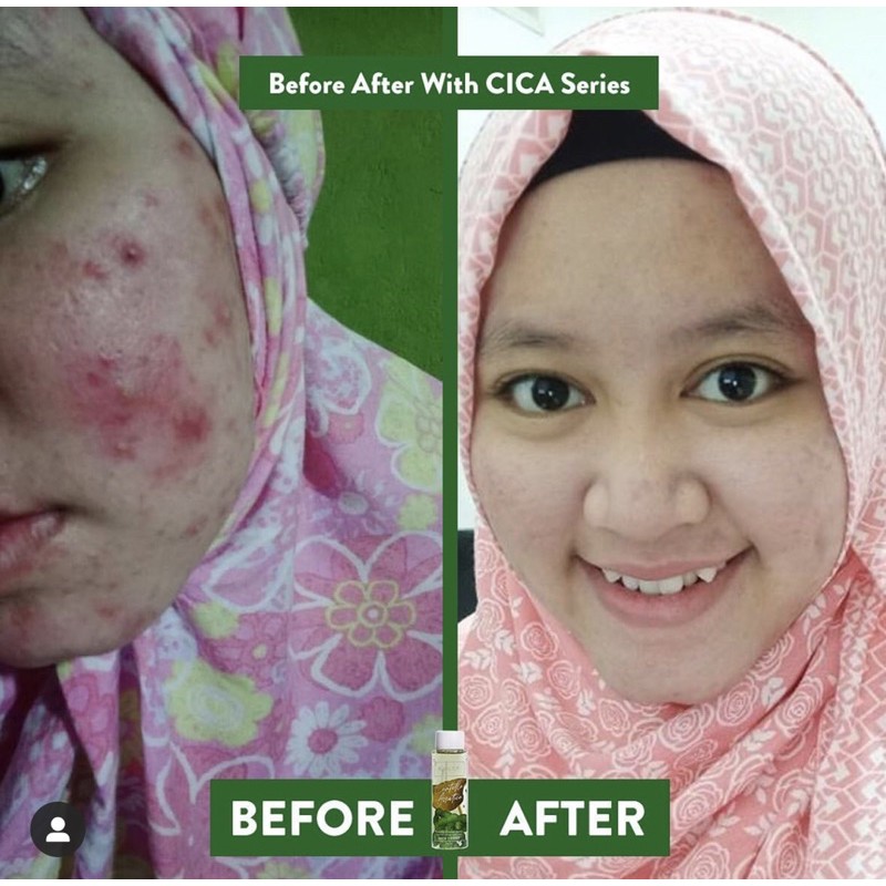 Npure Day Cream Centella Asiatica Cica Series