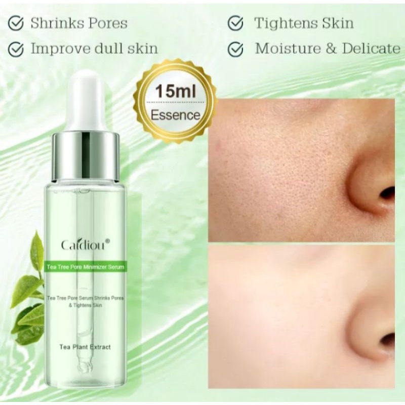 CAIDIOU TEA TREE PORE MINIMIZER | SERUM PENGECIL PORI |