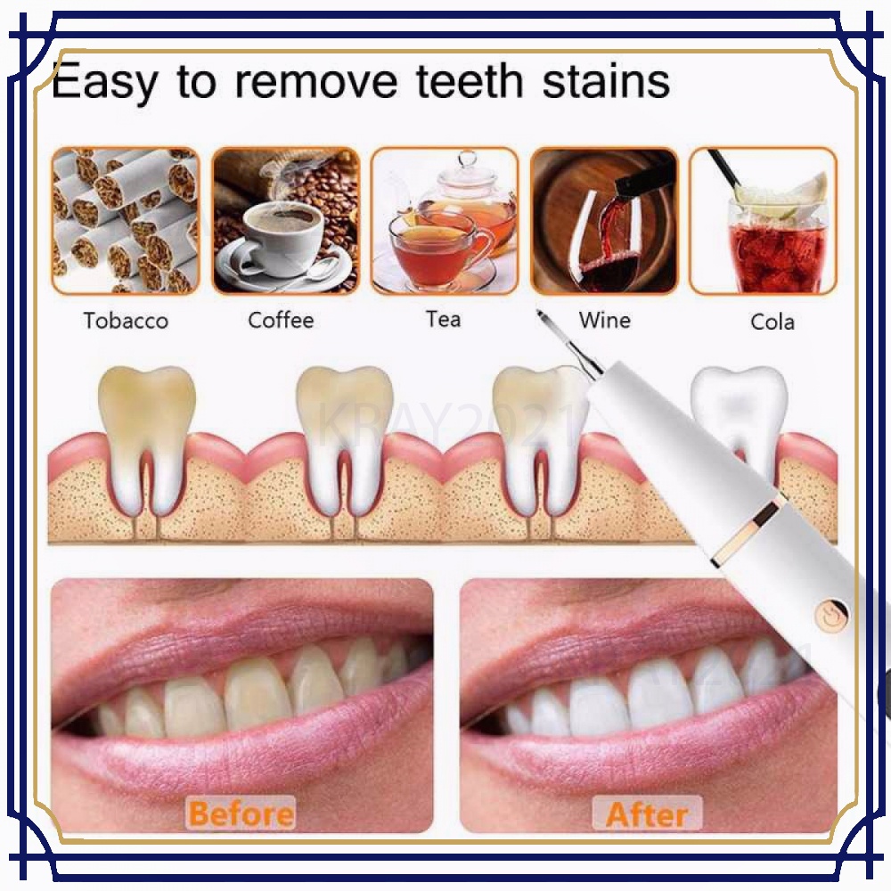 Pembersih Karang Plak Gigi Ultrasonic Dental Electric HT212