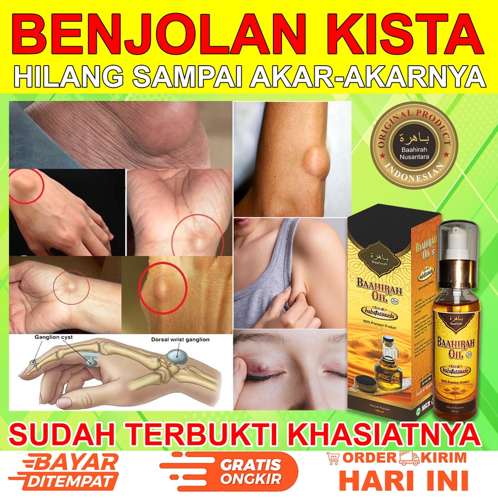 Baahirah Oil (TERLARIS) Obat segala benjolan tubuh