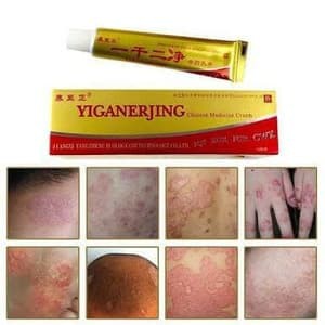 Yiganerjing Obat Gatal Jamur Salep Eksim Yiganerjing Dermatitis Salep Cream Herbal Gatal Kulit