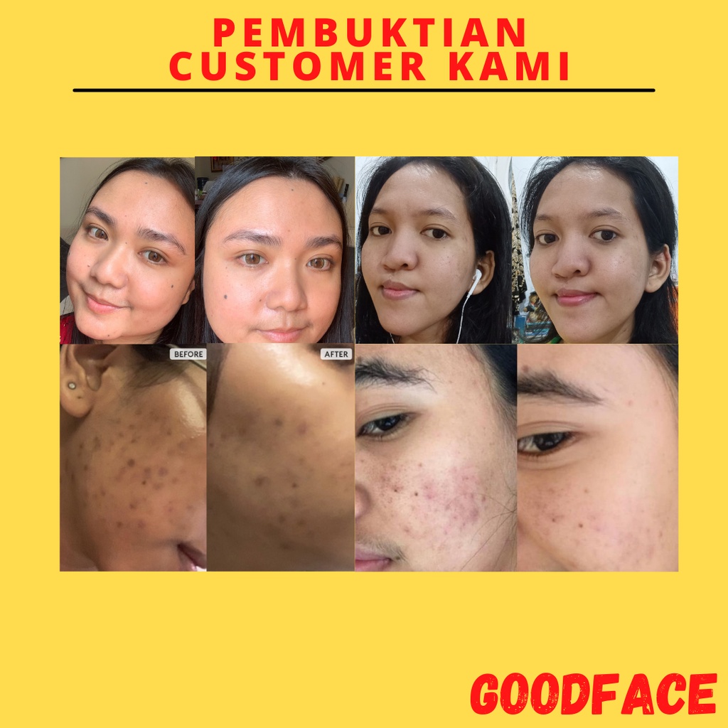 Serum Flek Hitam SOMETHINC Lemonade Waterless Vitamin C+Ferulic+NAG Perawatan Wajah