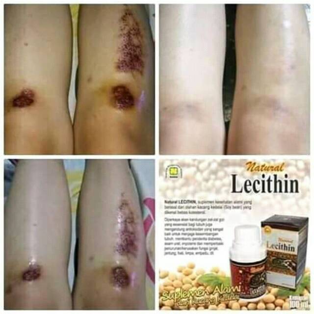 

Natural Lecithin Besar