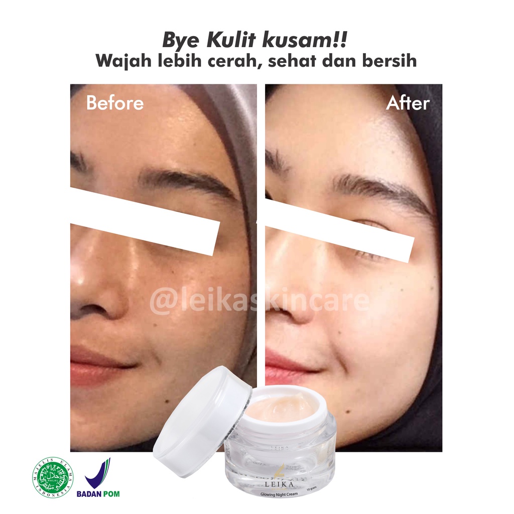 Menakjubkan! Cream Pencerah Wajah Kusam Glowing Cepat untuk Remaja BPOM Pria Wanita Asli Ampuh Krim Pemutih dan Pencerah / Perawatan wajah glowing HALAL MUI