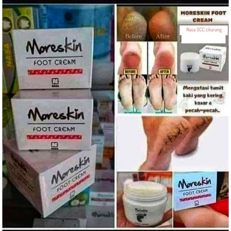 KRIM PERAWATAN TELAPAK KAKI PECAH-PECAH MORESKIN FOOT CREAM