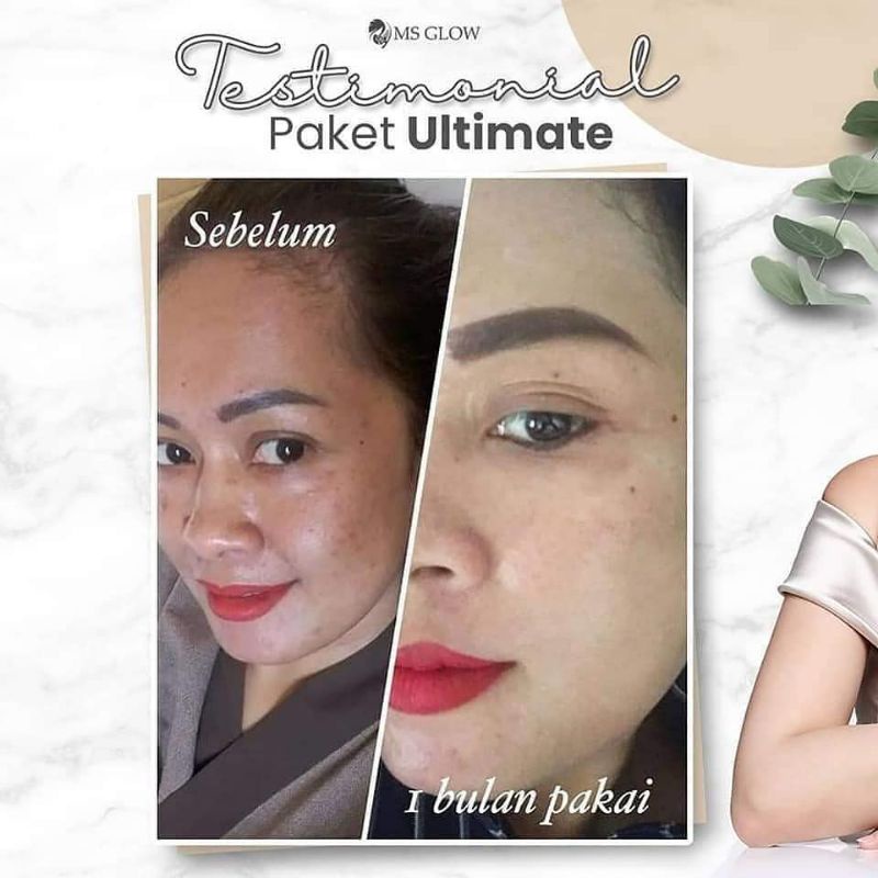 MS GLOW PAKET WAJAH  (WHITENING/LUMINOUS/ULTIMATE/ACNE/WHITE CELL DNA) FREE GIFT-4