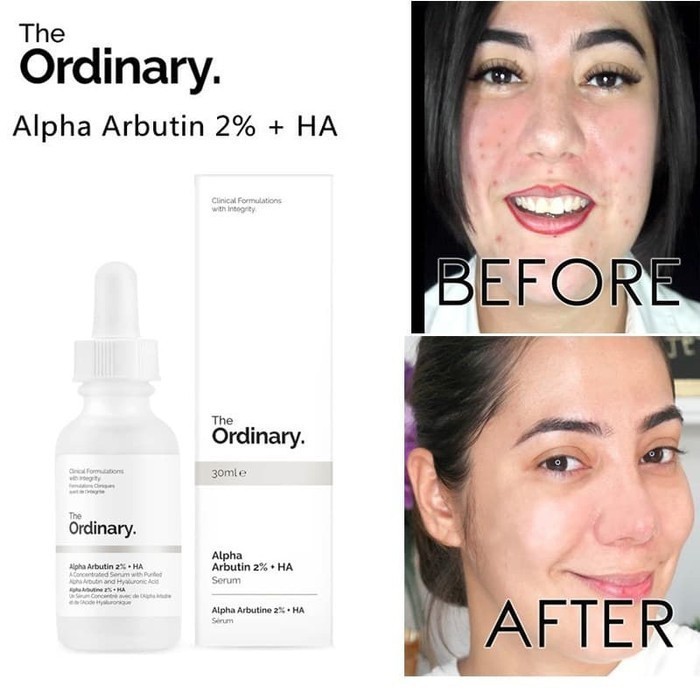 Original The Ordinary Alpha Arbutin 2% + HA serum wajah asli dari DECI