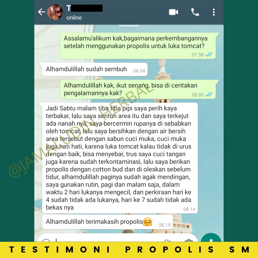 PROPOLIS SM - Obat Eksim Gatel Gatal Kulit Jamur Herbal - Obat Kulit Herbal - Obat Gatal - Obat Luka Diabetes - Obat Penyakit Kulit - Obat Exim - Obat Gatal Kulit - Obat Oles Bisul Jerawat Darah Kotor - Obat Salep Gatal Gatel Kulit Jamur Bakteri-8