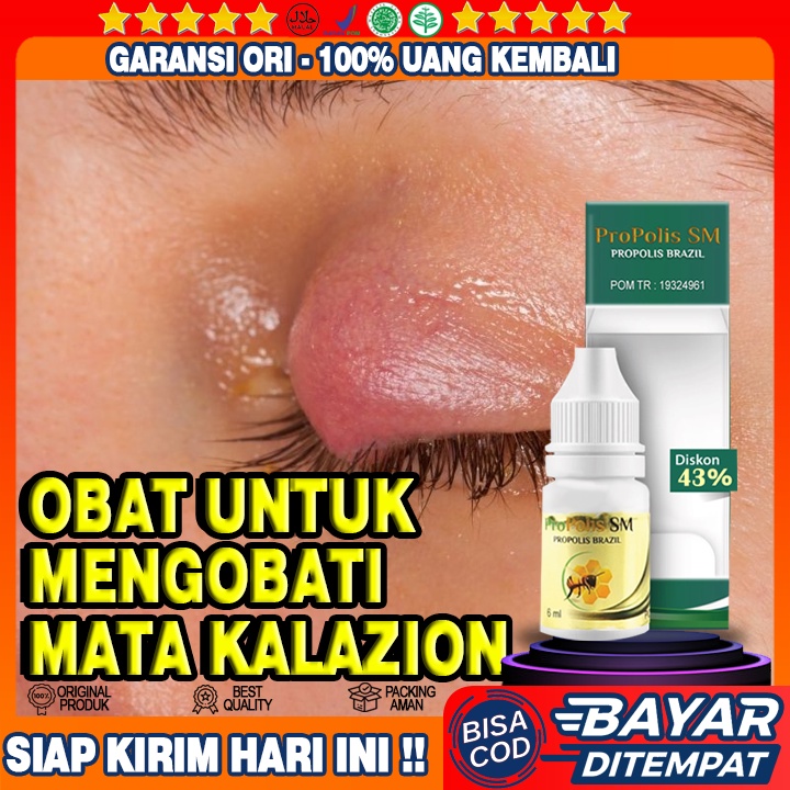 Jual Obat Benjolan Kalazion Sakit Kelopak Mata Mata Bintitan Bintik Putih Di Kelopak Mata