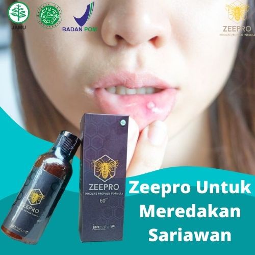 Obat Sariawan, Bau Mulut, Bibir Pecah-Pecah ZEEPRO 60ml