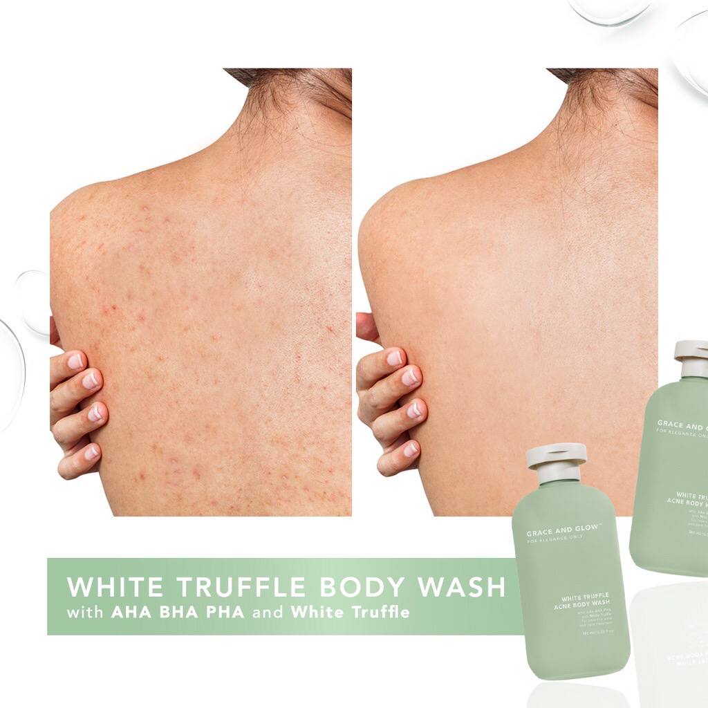 Grace and Glow White Truffle Acne Body Wash