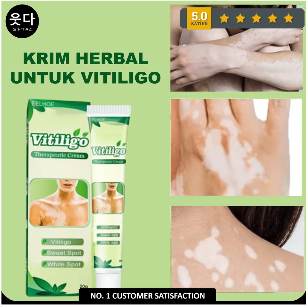 Obat Salep Vitiligo Eelhoe Krim Herbal Penghilang Bintik Putih