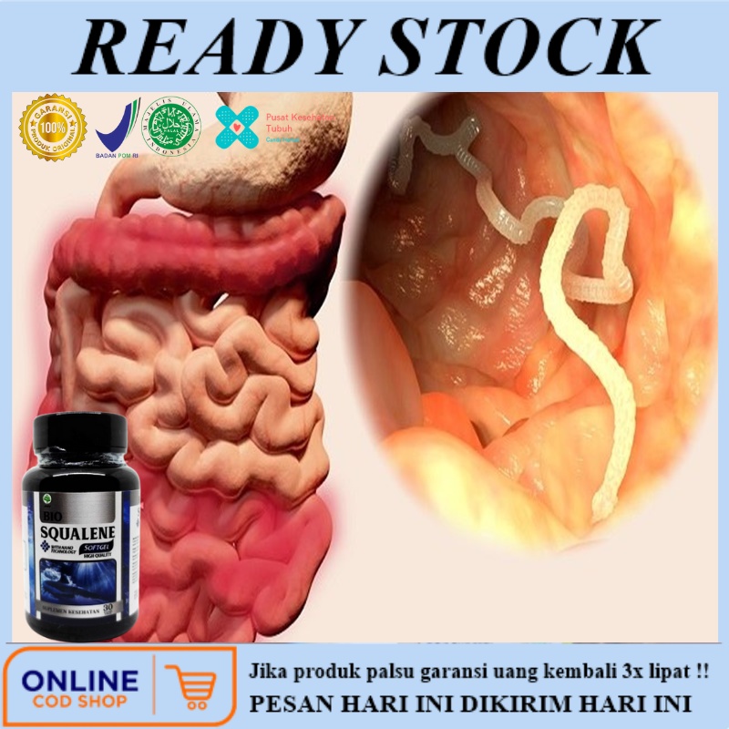 Obat Herbal Cacingan Untuk Dewasa & Anak Anak, Obat Cacing Usus, Cacing Kremi, Cacing Pita, cacing g