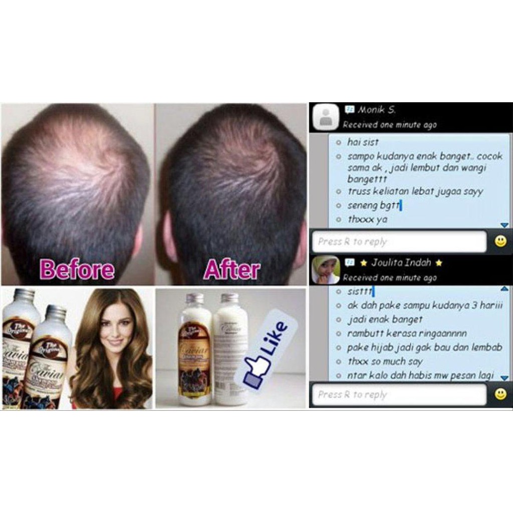 Shampo Shampoo Kuda Obat Penumbuh Rambut Mengatasi Pencegah Kebotakan