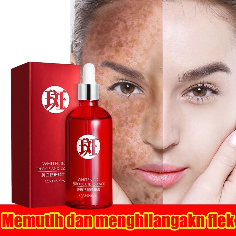 【O'RANNLE】Serum Anti Aging Kaya Antioksidan Samarkan Garis Halus Dan Flek Hitam Cocok Untuk Pemula serum menghilangkan flek Memutih dan menghilangakn flek Krim menghilangkan flek Noda hitam Bintik hitam Bintik penuaan Melasma Bintik paparan sinar mata