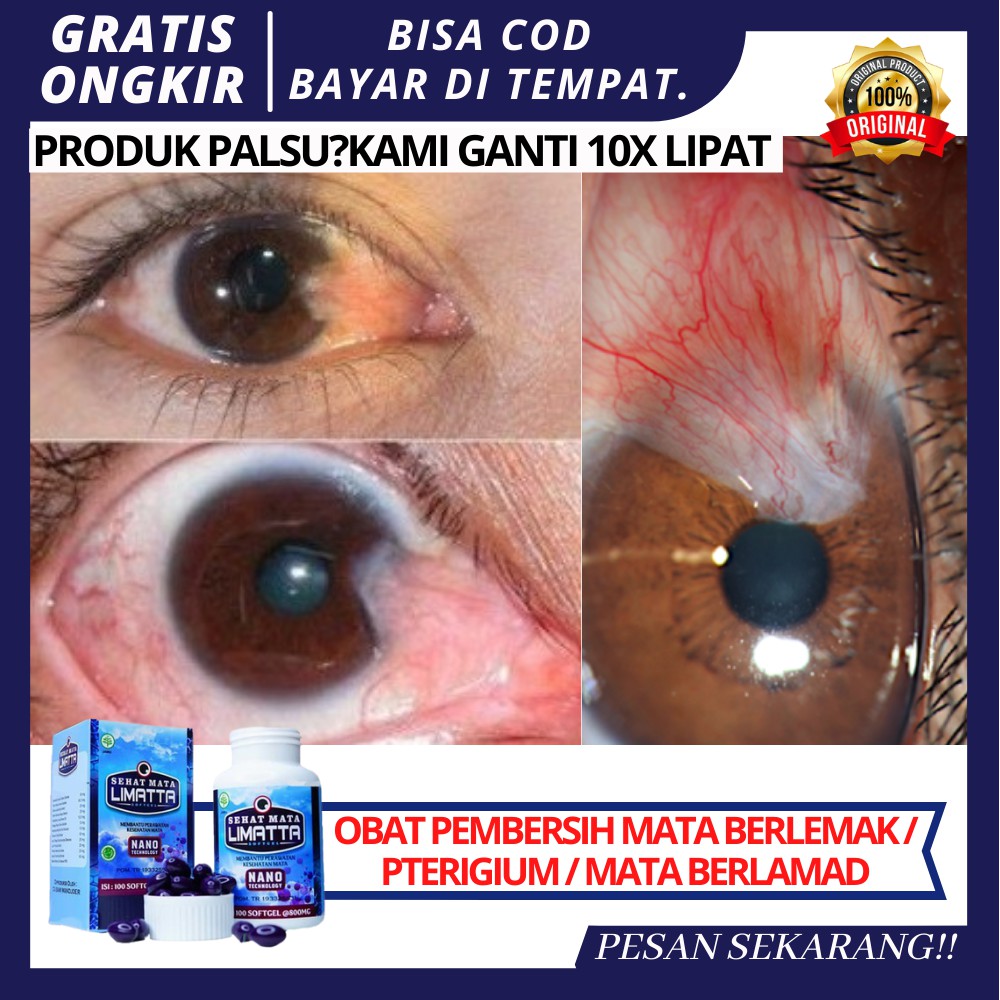 Obat Mata Berlemak / Pembersih Mata Berlemak / Mata Berlamad / Mata Berselaput / Obat Mata Pterigium