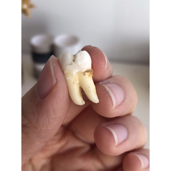Gigi Praktikum Asli Molar 1, Molar 2, Molar 3 Rahang Bawah