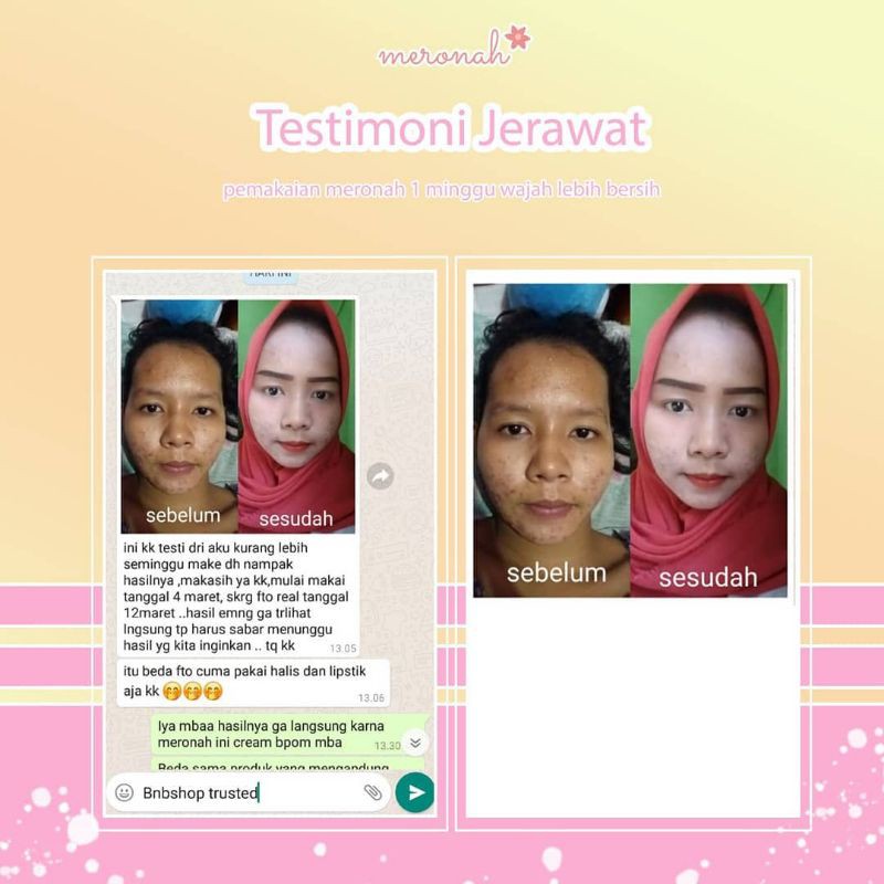 PAKET WAJAH JERAWAT/SENSITIVE/FLEK KUSAM  MERONAH(JERAWAT,BRUNTUS,FLEK)