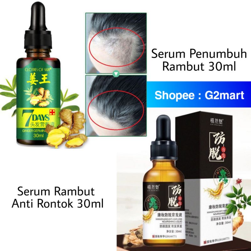 Serum Anti Rontok Zhi Ran Mei Cairan Essence Penumbuh Rambut Clothes of Skin 7 Days Ginger Germinal Oil 30ml