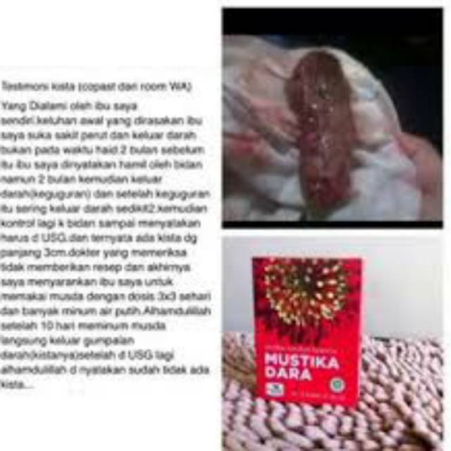 Mustika dara