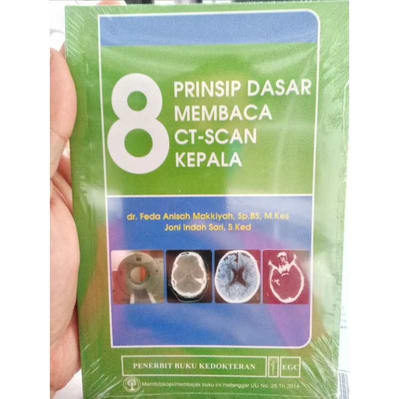 8 Prinsip Dasar Membaca CT-Scan Kepala