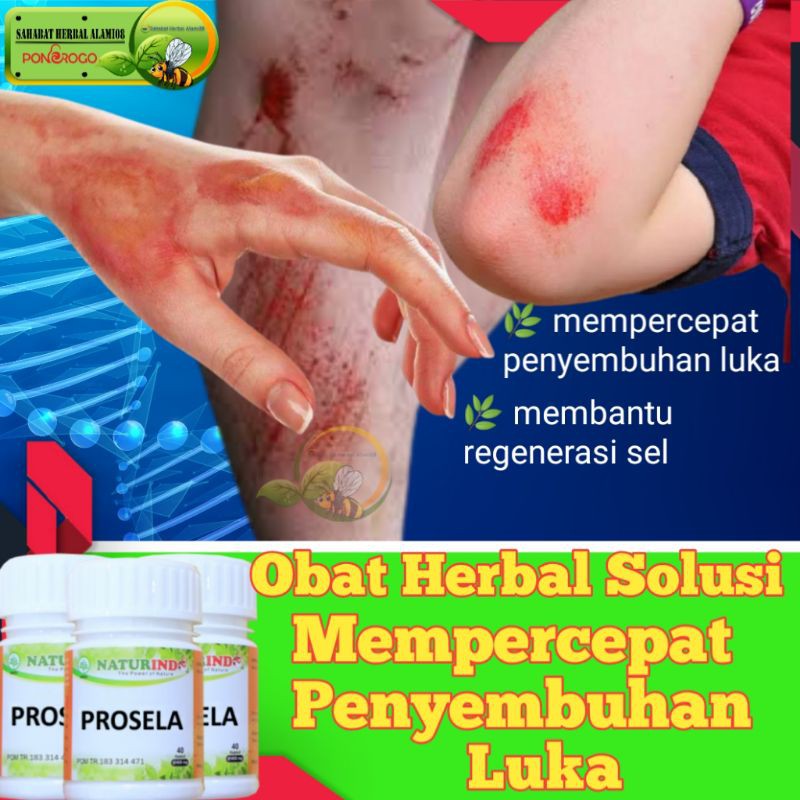 

OBAT HERBAL PENYEMBUHAN LUKA LUAR DENGAN CEPAT, SUPLEMEN MAKANAN KESEHATAN SEL TUBUH || PROSELA