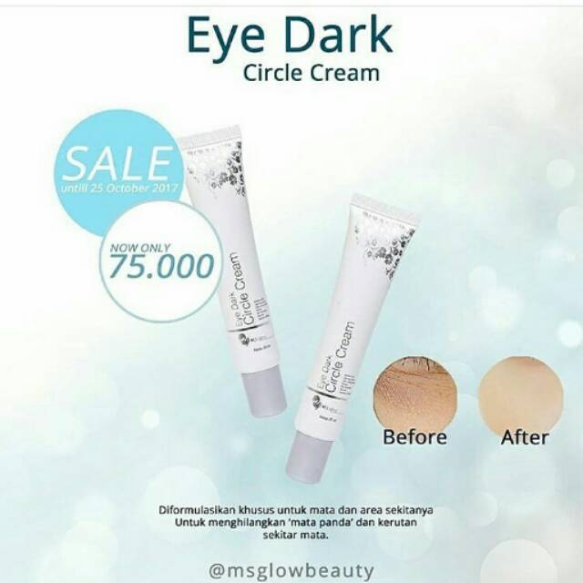 Promo / DISKON krim mata panda MS GLOW EYE CREAM OTIGINAL