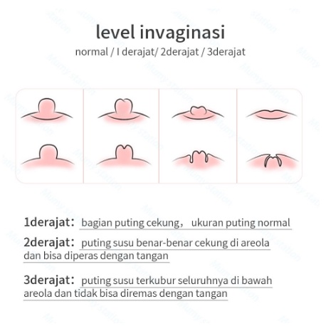 Alat Penarik Puting Payudara Bahan Silikon Mumystation Cup Vakum Penarik Puting Payudara untuk Alat Kesehatan Ibu Hamil