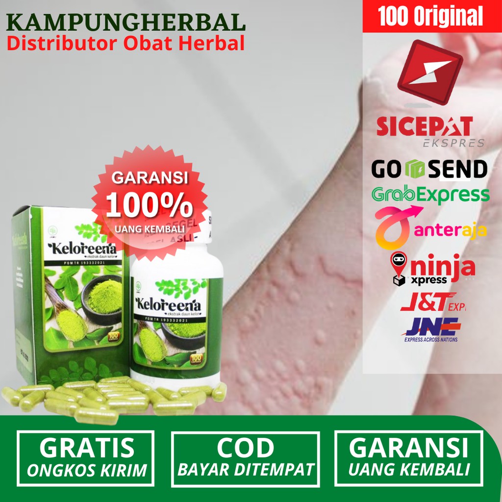 Obat Herbal Biduran Karena Alergi Dingin Gatal Gatal Kaligata Aman Untuk Ibu Hamil Ibu Menyusui Shopee Indonesia