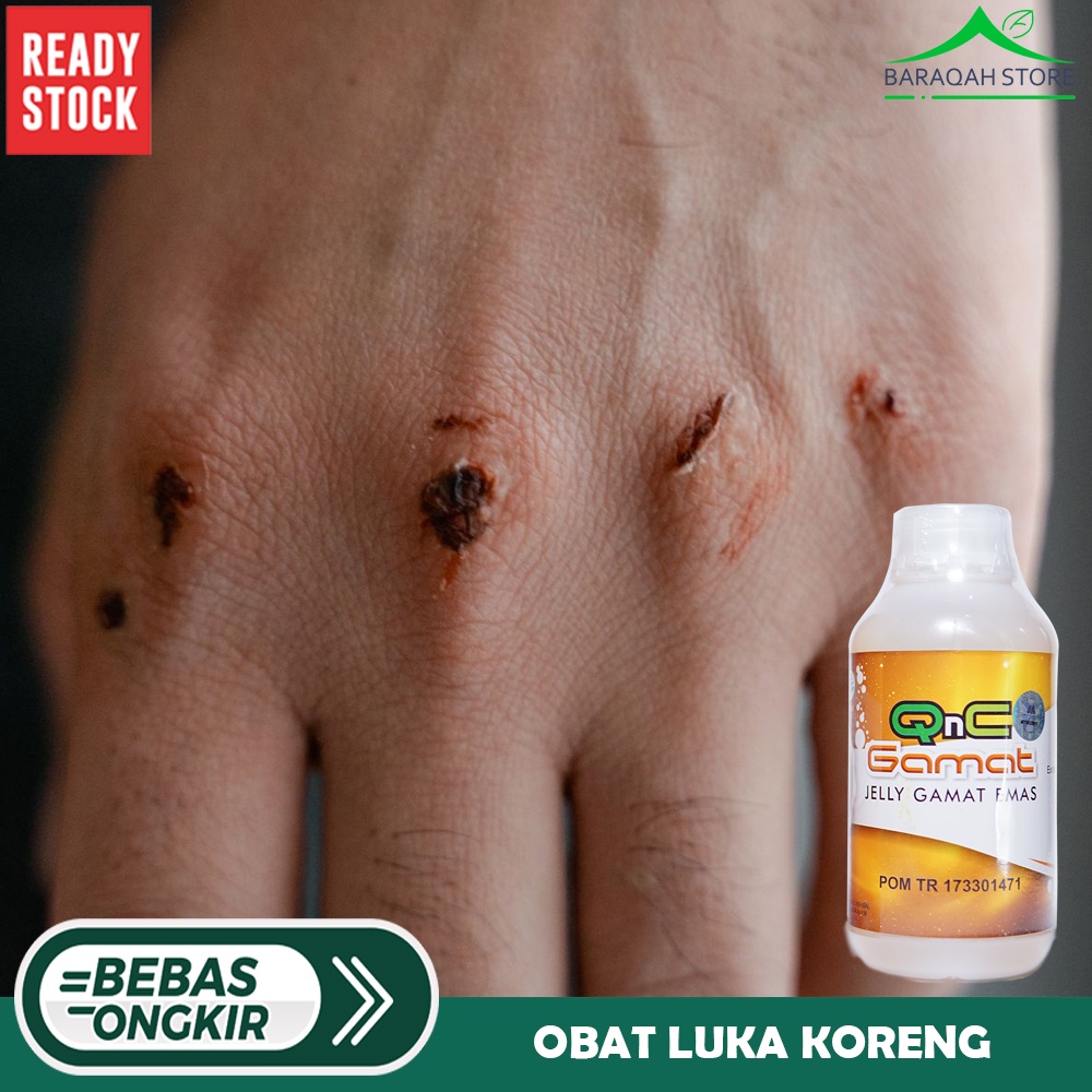 Obat Luka Koreng, Obat Luka Sunat Cepat Kering, QNC Jelly Gamat Original
