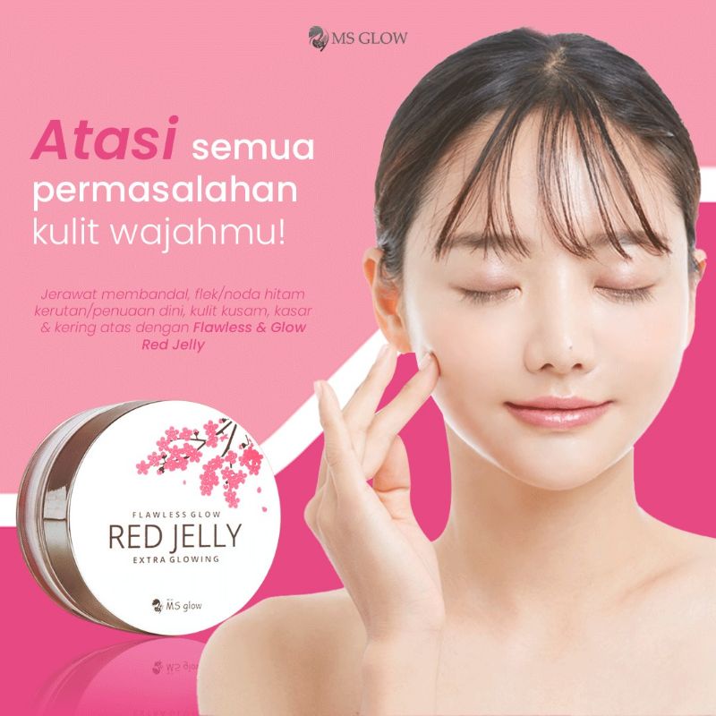 RED JELLY MS GLOW/RED JELLY/MS GLOW