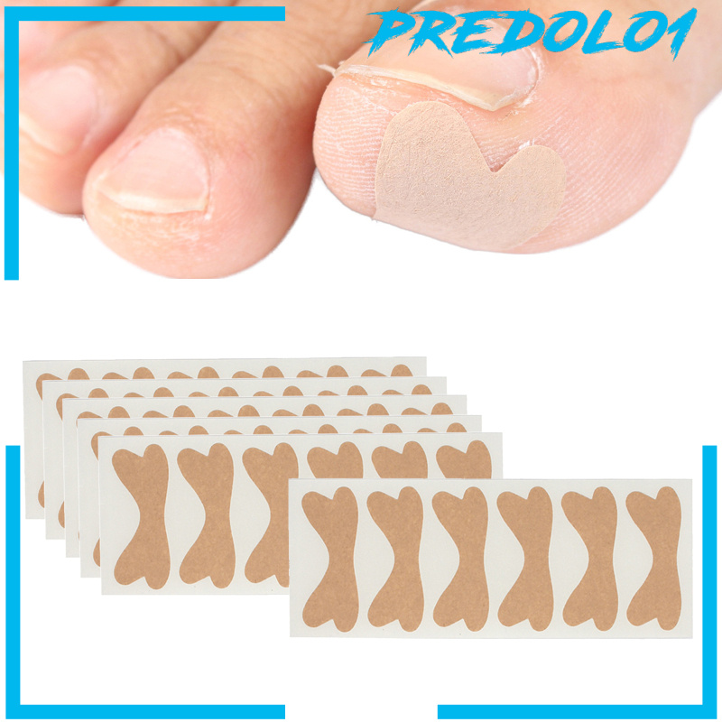 [PREDOLO1]Ingrown Toenail Stickers Elastic Glue Free Painless Nail Correction Foot nail Patches for Women Men