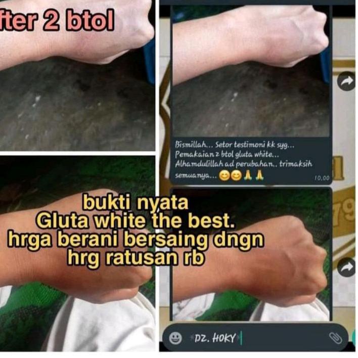 ⭐Review Gluta White KFS Original Bpom Susu Pemutih Badan |Promo|launching|New