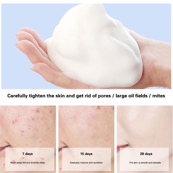 Milk Cleanser Asam Amino Pembersih Wajah Jerawat Pembersih wajah pemutih Pembersih wajah penghilang komedo 150ML Pori-pori bersih dalam Mengurangi wajah berminyak Penghapusan komedo yang kuat Mengurangi jerawat