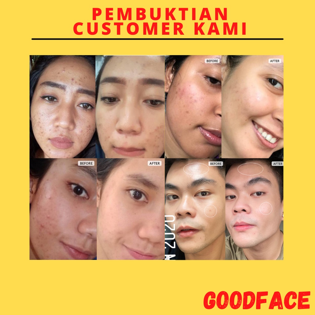 Serum Untuk Kulit Kering SOMETHINC AHA 7%, BHA 1%, PHA 3% Weekly Peeling Solution - 20ml