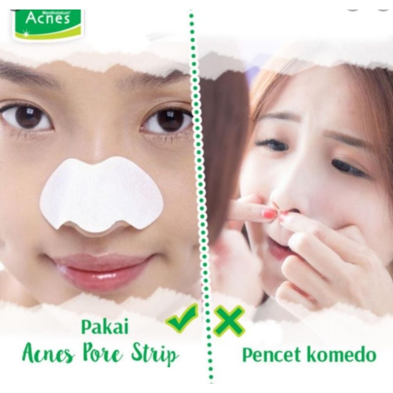 `ღ´ PHINKL `ღ´ a̳c̳n̳e̳s̳ Acnes Pore Strip plester angkat komedo kertas untuk mengecilkan pori