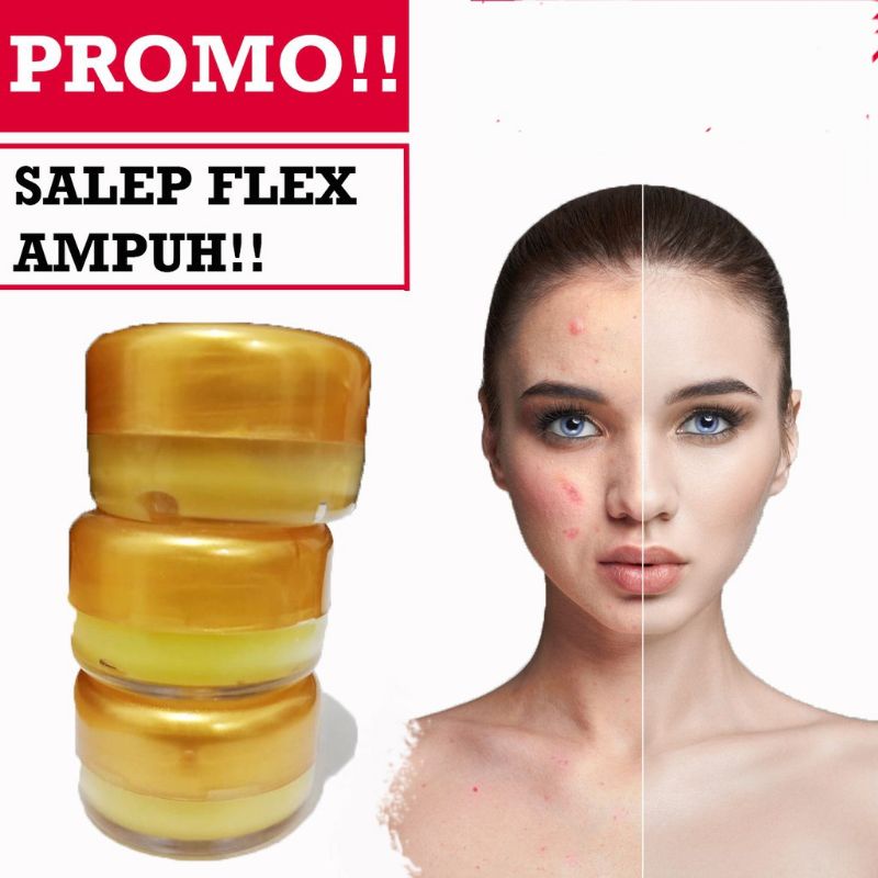 SALEP FLEX HITAM MELASMA AMPUH /  Salep Wajah Untuk Menghilangkan Flex Hitam