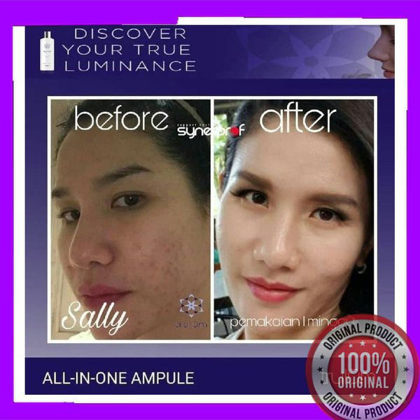 Obat Serum Hilangkan Kerutan Wajah Cepat cream khusus penghilang flek hitam Membandel Secara Alami