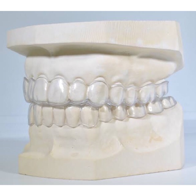 RETAINER GIGI / PENCEGAH GIGI BERANTAKAN / CUSTOM FIT / ESSIX 