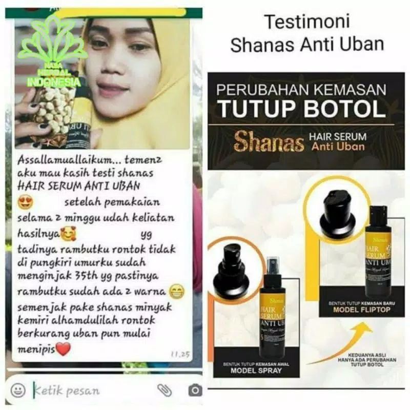 SSS Terlaris Serum Penghilang Uban Shampo Anti uban shanas ampuh