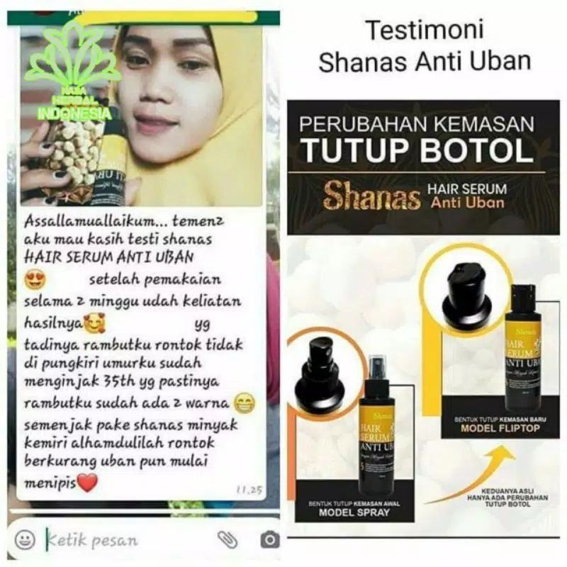 COD FREE ONGKIR Terlaris Serum Penghilang Uban Shampo Anti uban shanas ampuh