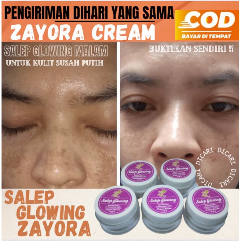 cod Cream Flek Hitam Salep Glow Zayora Skincare
