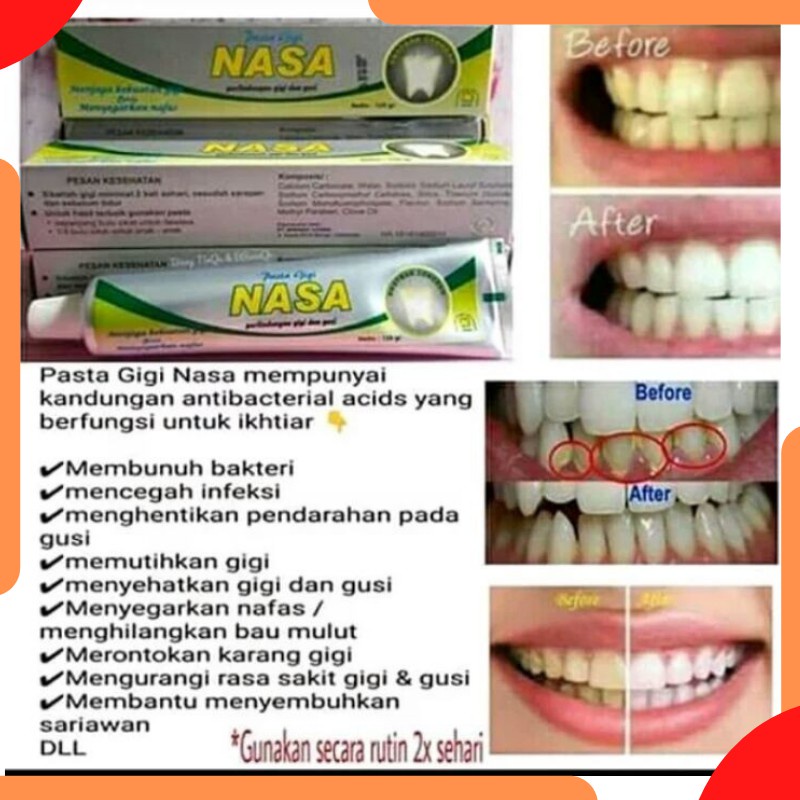 [2pcs] Nasa Odol Pasta Gigi dengan Berbagai Manfaat Complete Mouth Care Anti Bakteri Mulut &amp; Gusi 24 Jam Melindungi Bau Mulut