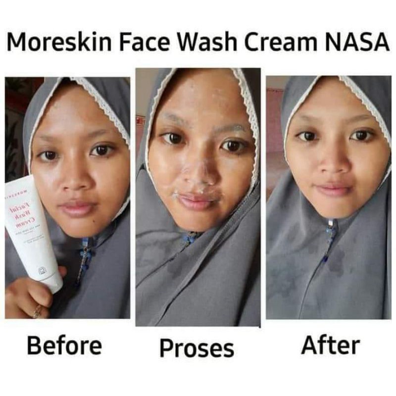 Moreskin Face Wash Cream Nasa