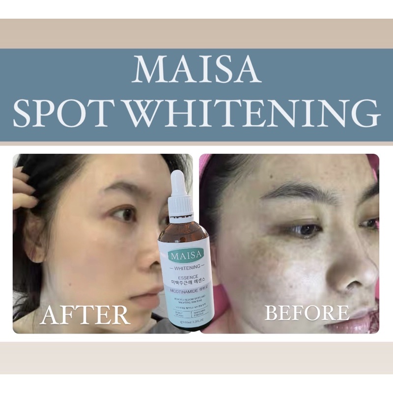 MAISA SPOT WHITENJNG ESSENCE