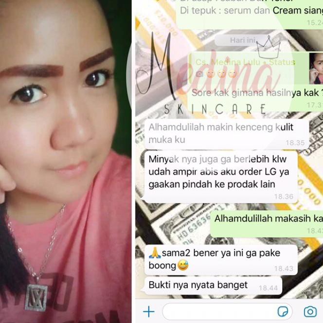 ☁ MEDINA SKINCARE ORIGINAL ( TANPA SERUM ) ➦