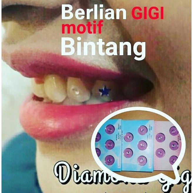 Berlian gigi motif bintang