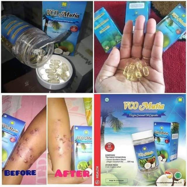 

VCO Mutia Virgin Coconut Oil Capsules / MINYAK KELAPA MURNI